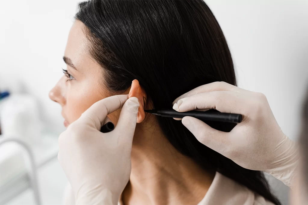 Otoplasti Nedir?